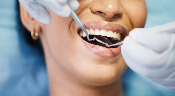 Best Emergency Dental Care for Broken or Chipped Teeth in Rockvale, TN